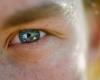 Eye health, Poor vision | Registers more young people with vision problems