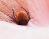 Ticks, the Tick Center | The tick center would like more pictures of skin rashes after tick bites